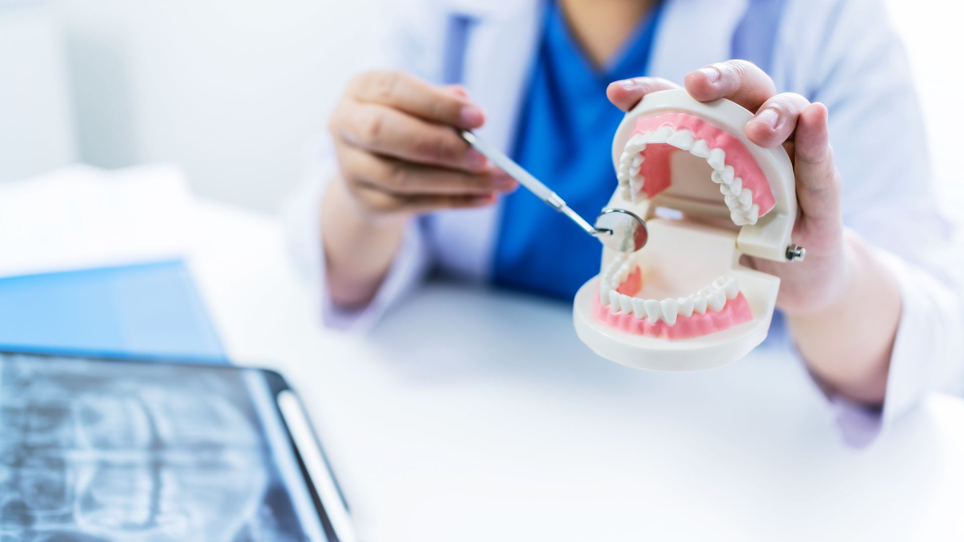 Full-Arch Restoration and All-on-4 Implants: The Ultimate Solution for a Complete Smile in Atlanta