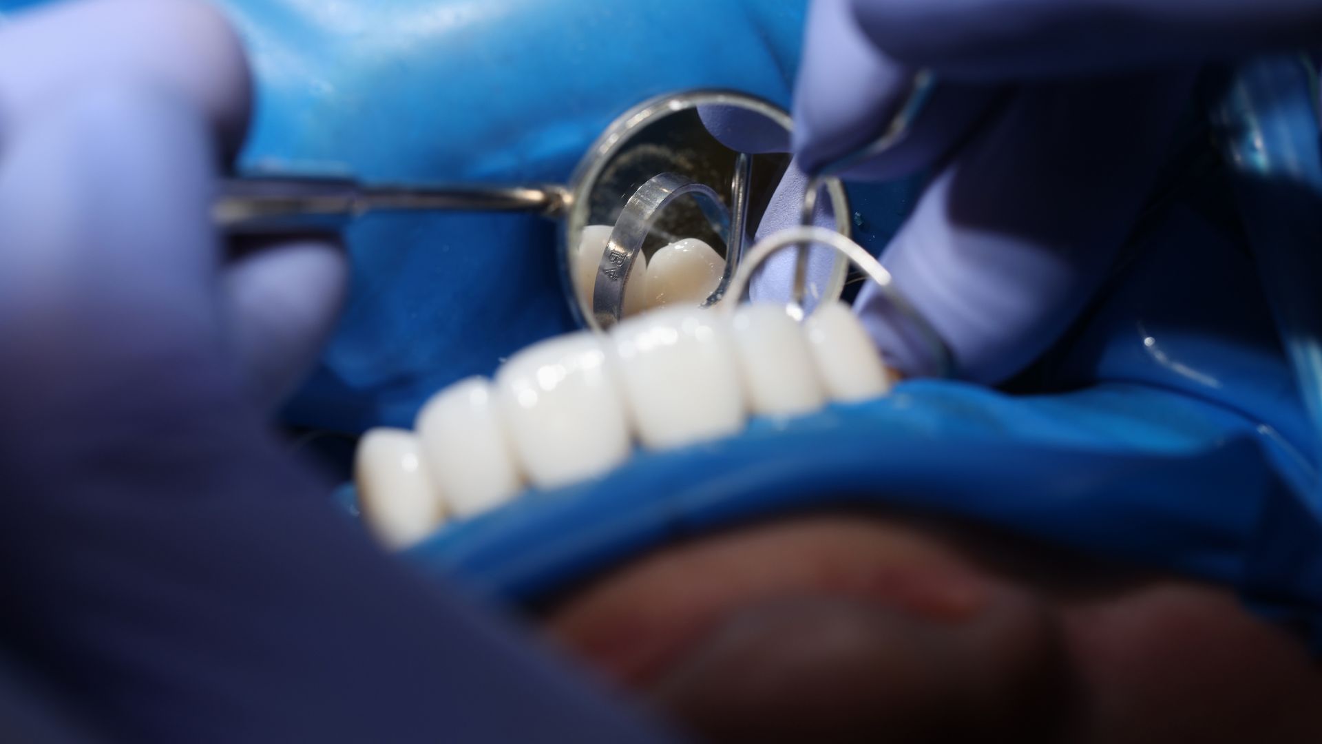 Atlanta oral and facial surgery
