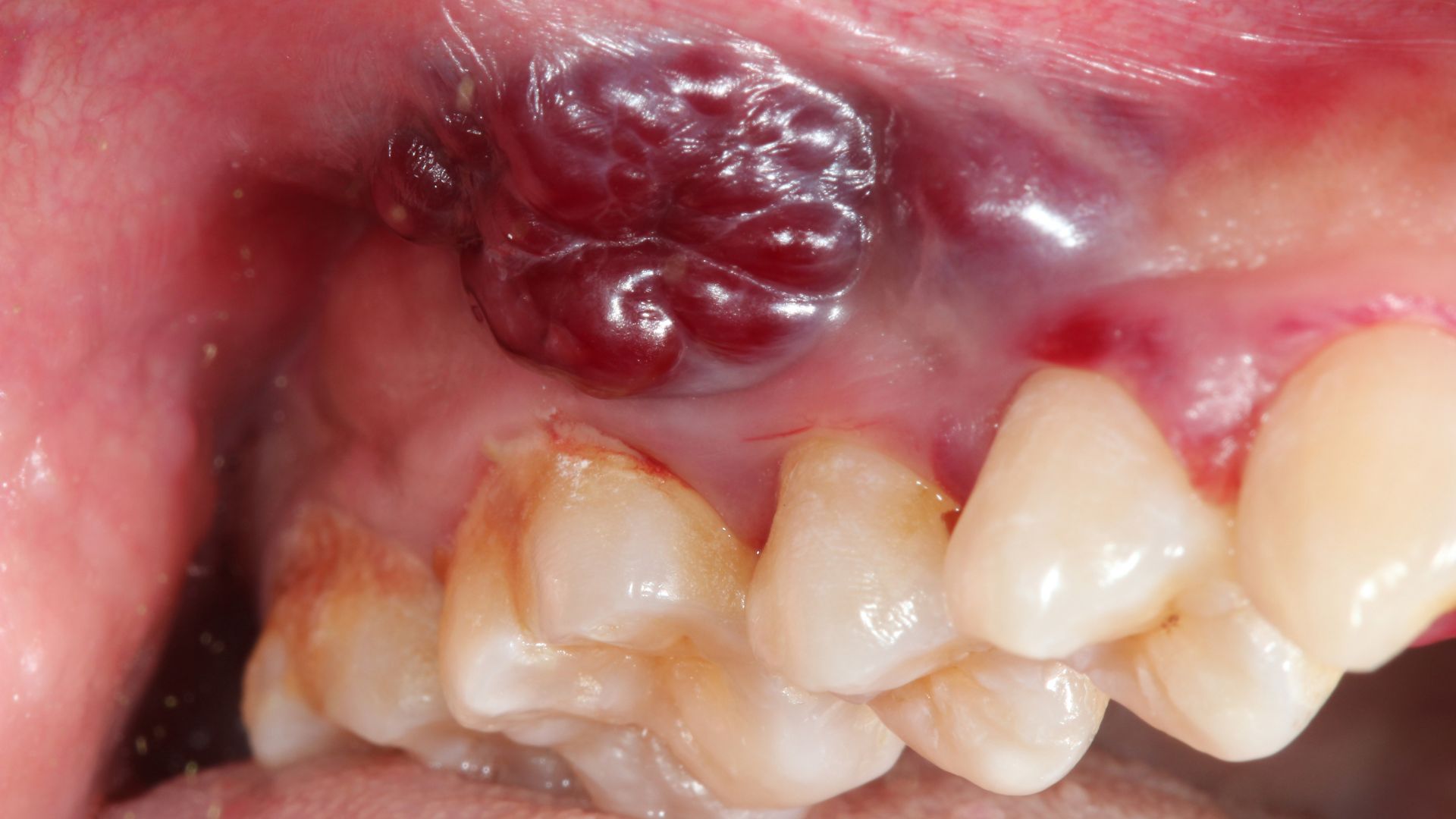 Atlanta oral and facial surgery