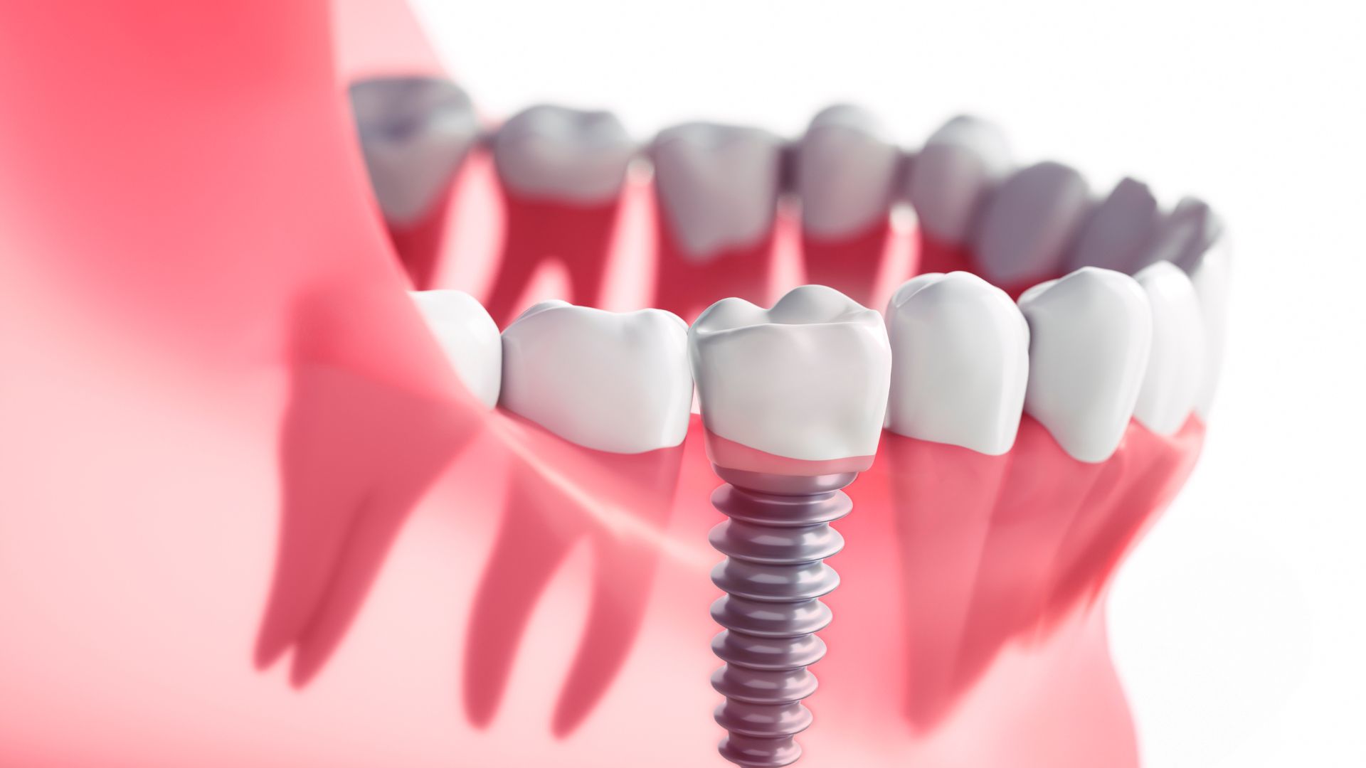 Atlanta oral and facial surgery