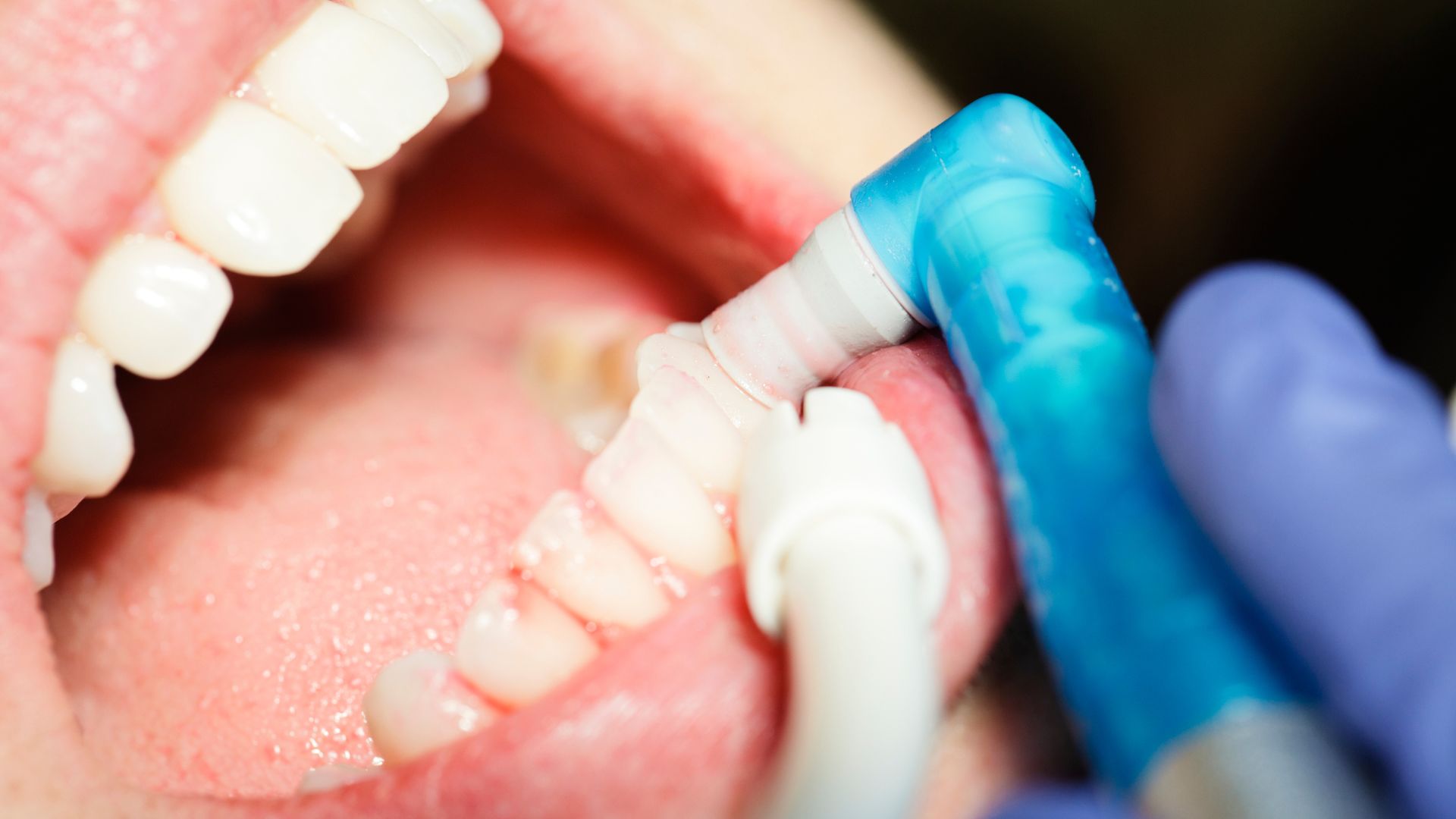 Implant Consultation Online